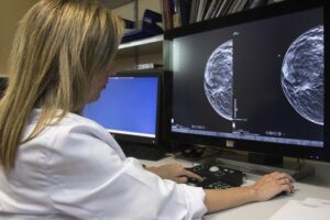 Una oncòloga observant una mamografia.Miguel Ángel Polo / EFE